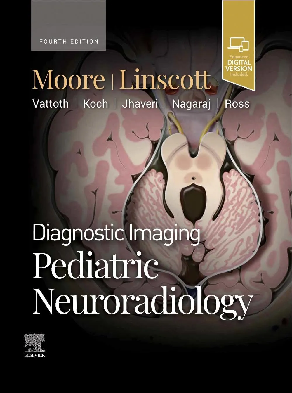 Diagnostic Imaging: Pediatric Neuroradiology -4E