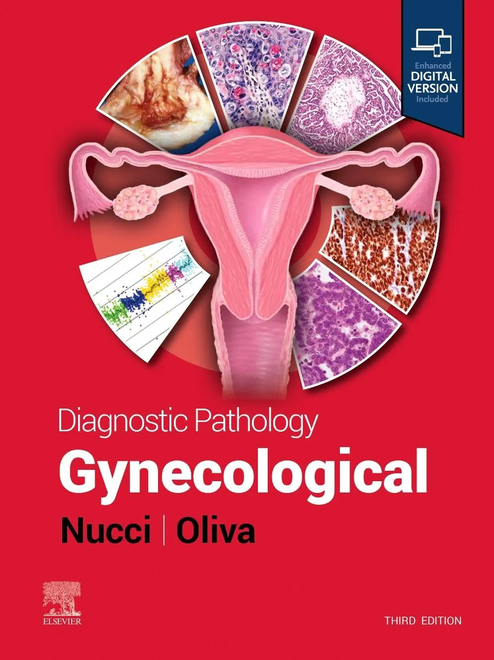 Diagnostic Pathology: Gynecological - 3E