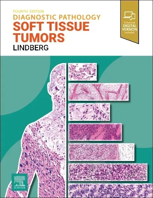 Diagnostic Pathology: Soft Tissue Tumors-4E