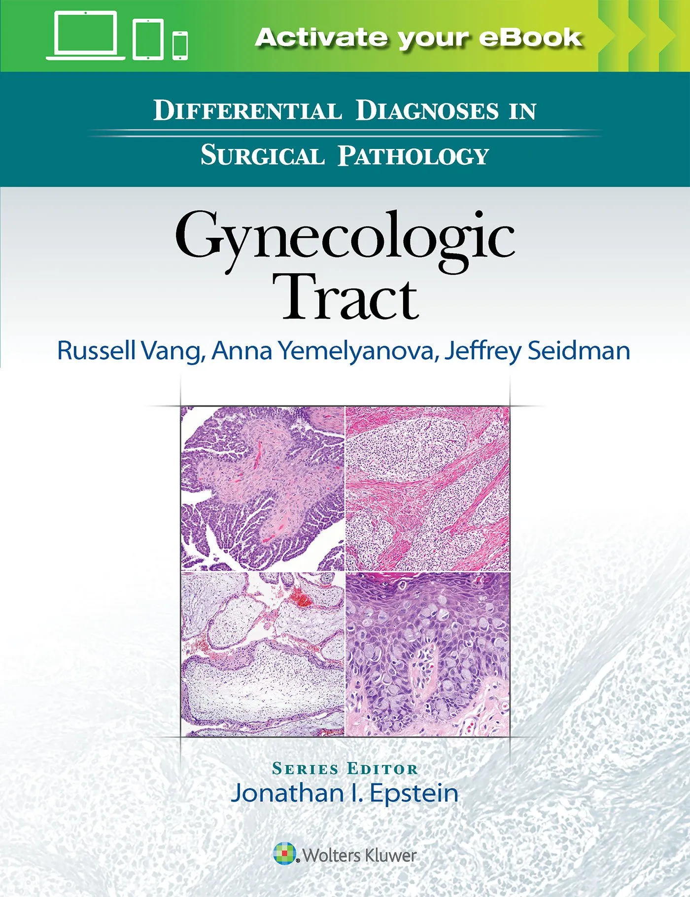 Differential Diagnoses in Surgical Pathology: Gynecologic Tract - 1st Edition