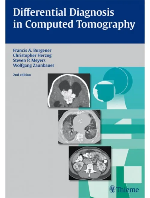 Differential Diagnosis In Computed Tomography - 2nd Edition