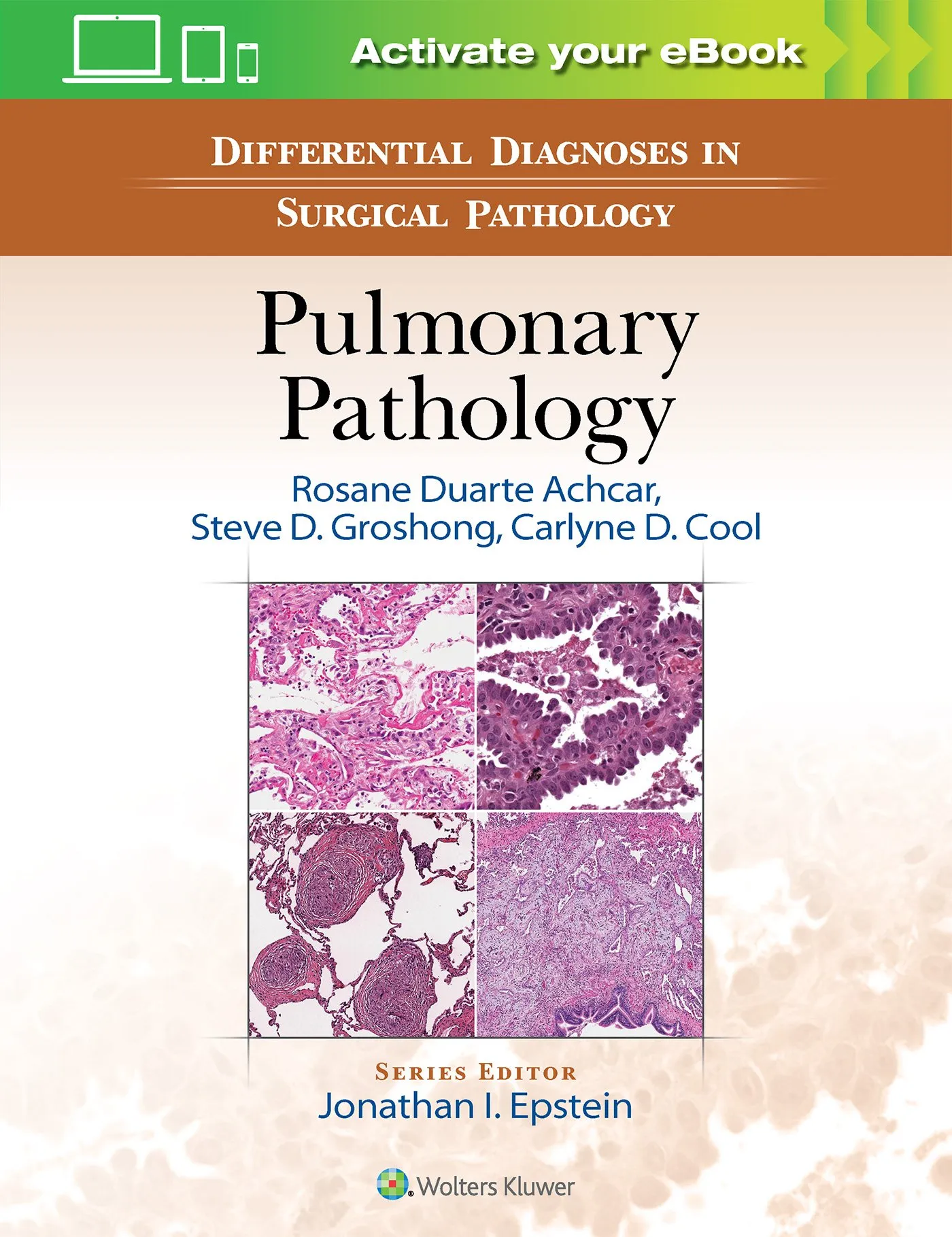Differential Diagnosis in Surgical Pathology: Pulmonary Pathology - 1st Edition