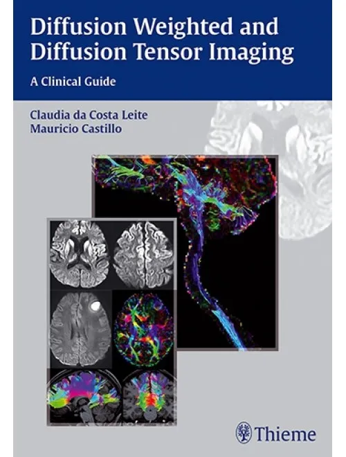 Diffusion Weighted and Diffusion Tensor Imaging A Clinical Guide - 1st Edition