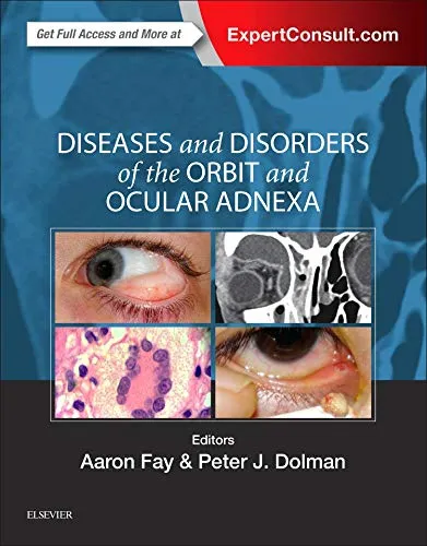 Diseases and Disorders of the Orbit and Ocular Adnexa: Expert Consult - Online and Print - 1E