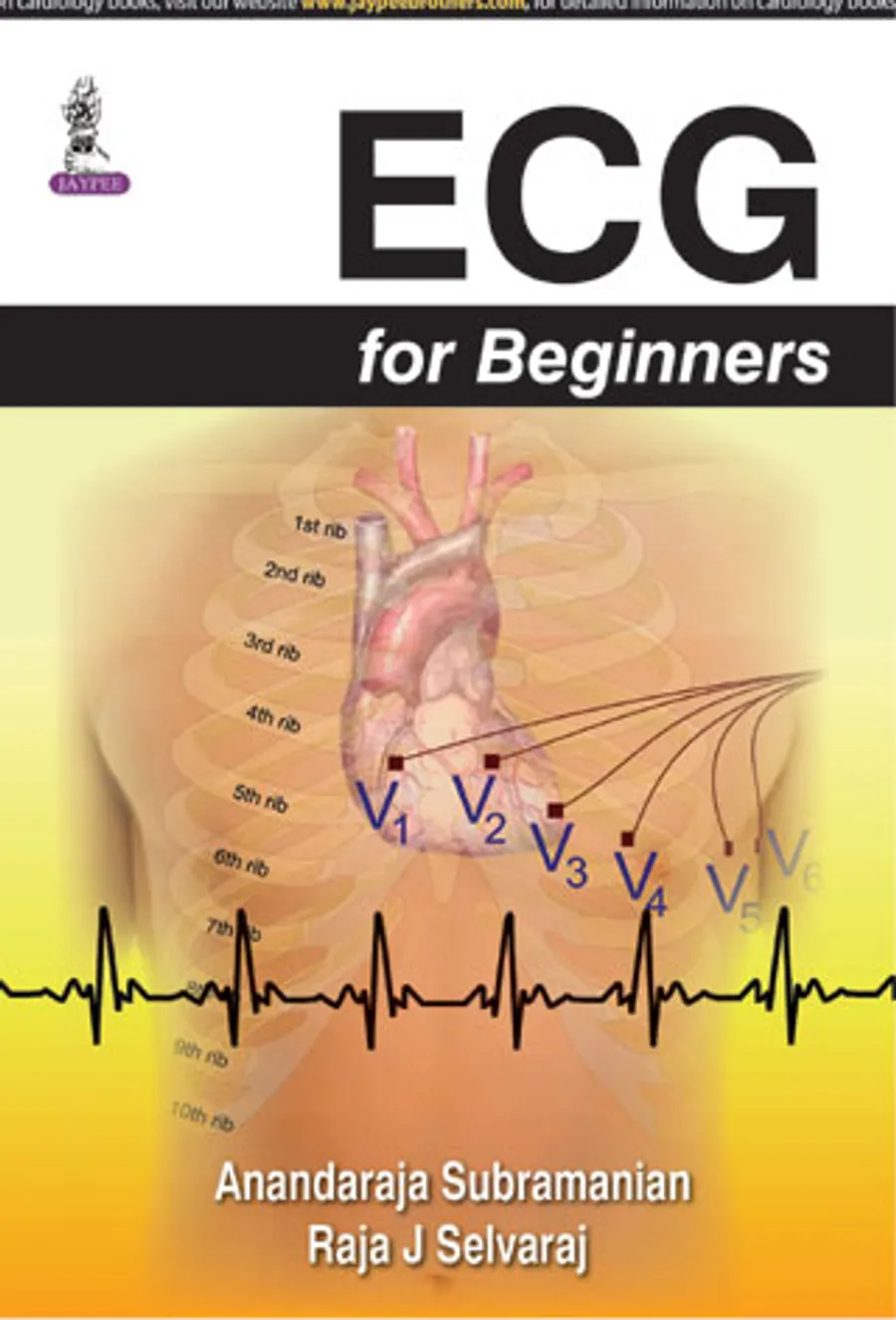 Image of ECG for Beginners