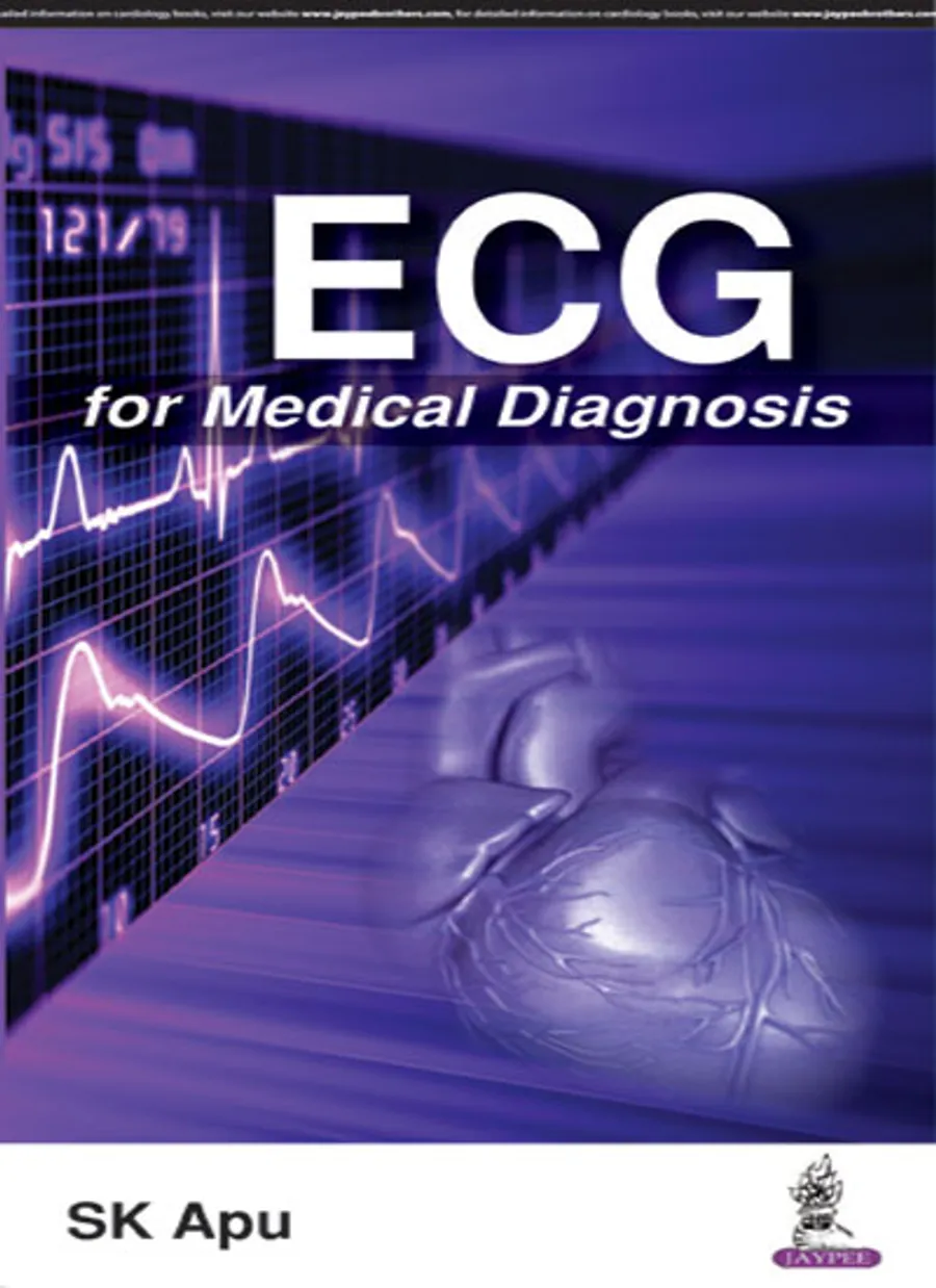 Image of ECG for Medical Diagnosis
