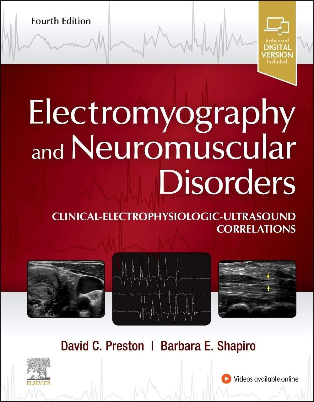 Electromyography and Neuromuscular Disorders: Clinical-Electrophysiologic-Ultrasound Correlations - 4ED