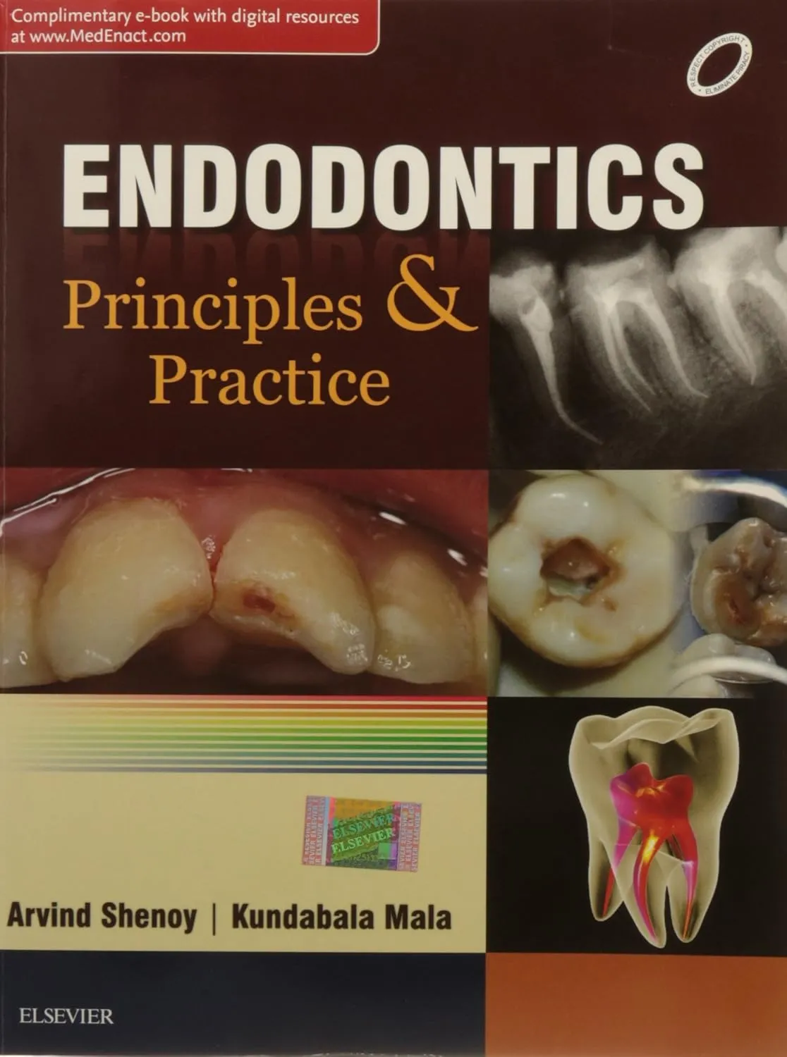 Endodontics: Principles and Practice