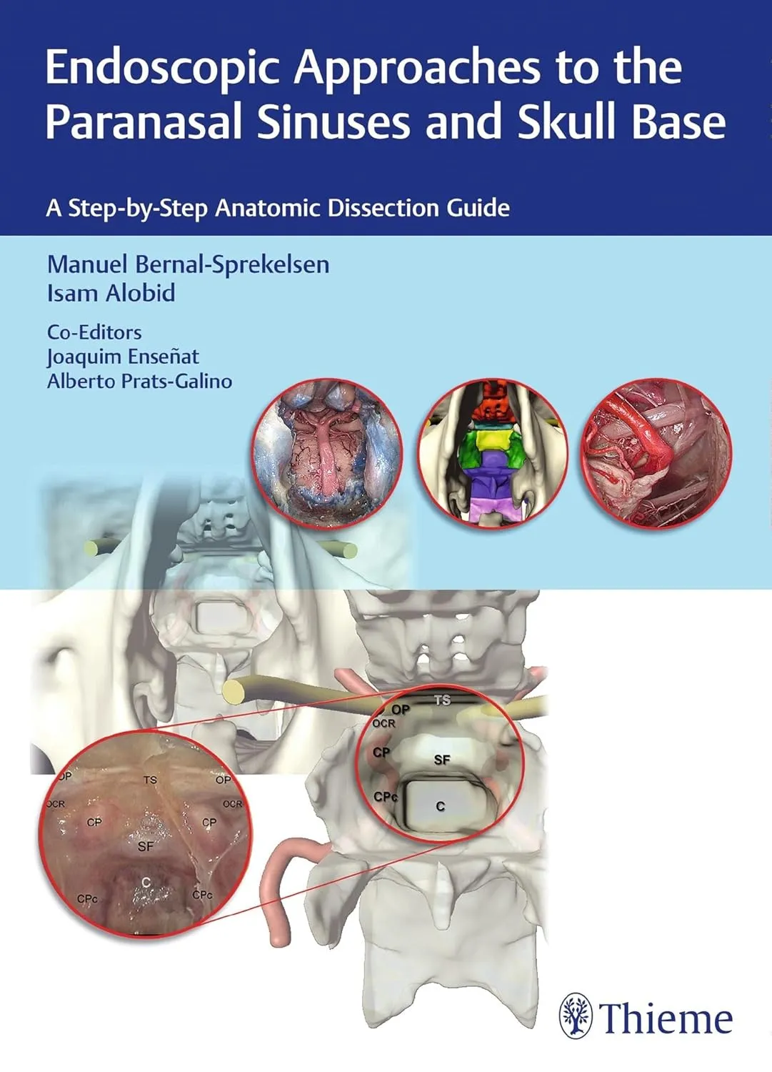Endoscopic Approaches to the Paranasal Sinuses and Skull Base 1st Edition