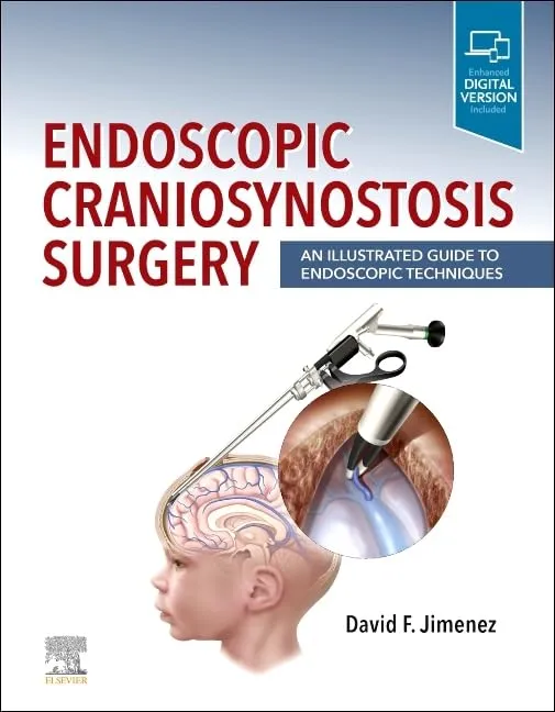 Endoscopic Craniosynostosis Surgery: An Illustrated Guide to Endoscopic Techniques - 1E