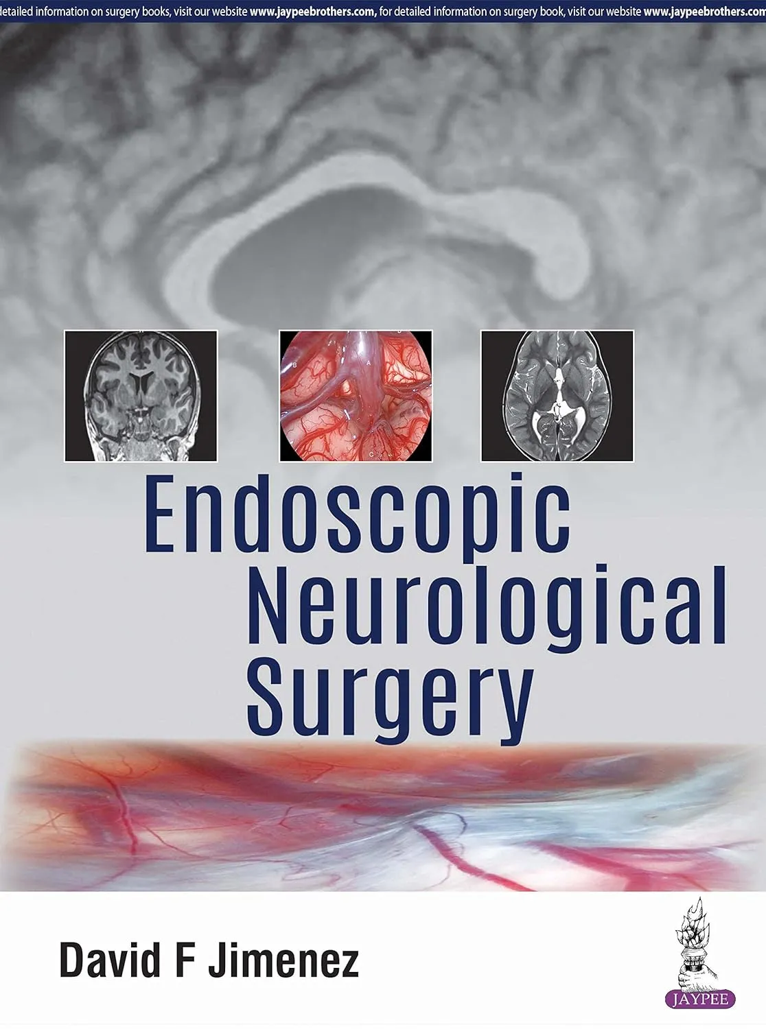 Endoscopic Neurological Surgery - 1st Edition 2019