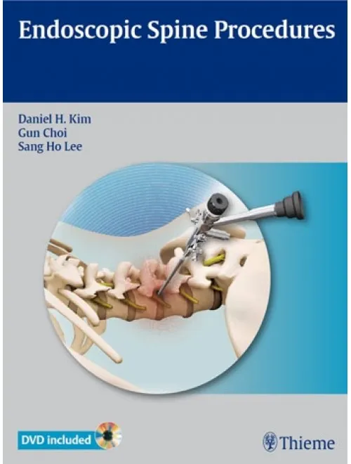 Endoscopic Spine Procedures - 1st Edition