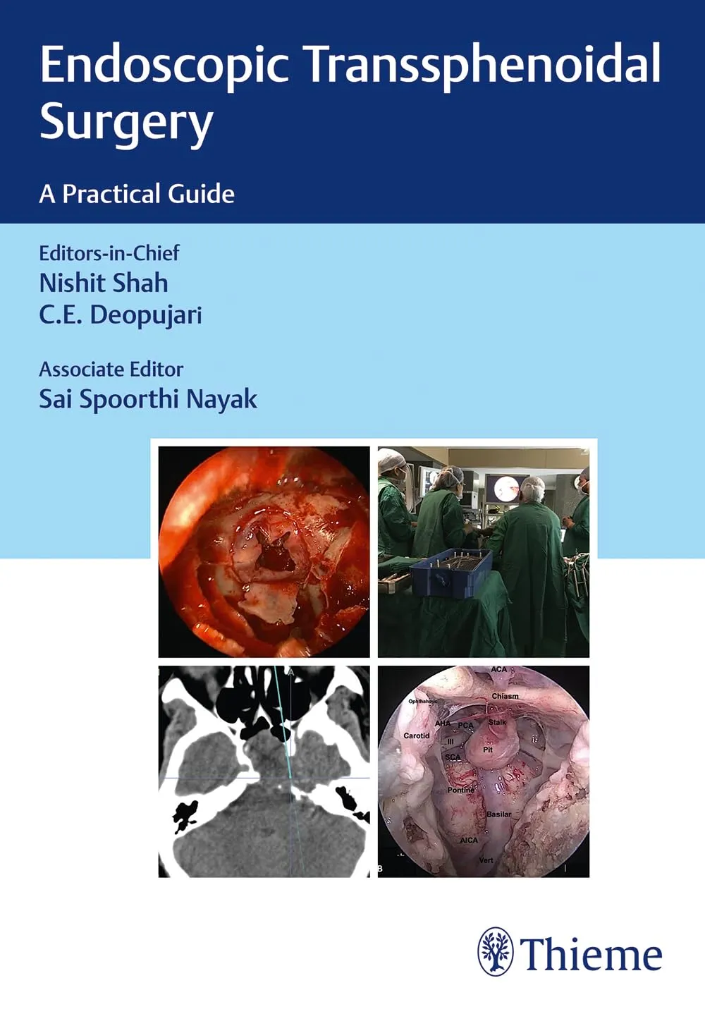 Endoscopic Transsphenoidal Surgery