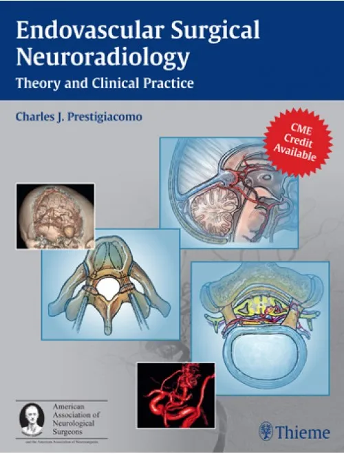 Endovascular Surgical Neuroradiology Theory and Clinical Practice - 1st Edition