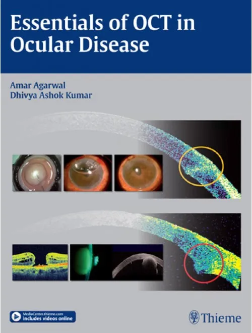 Essentials of OCT in Ocular Disease-1st Edition