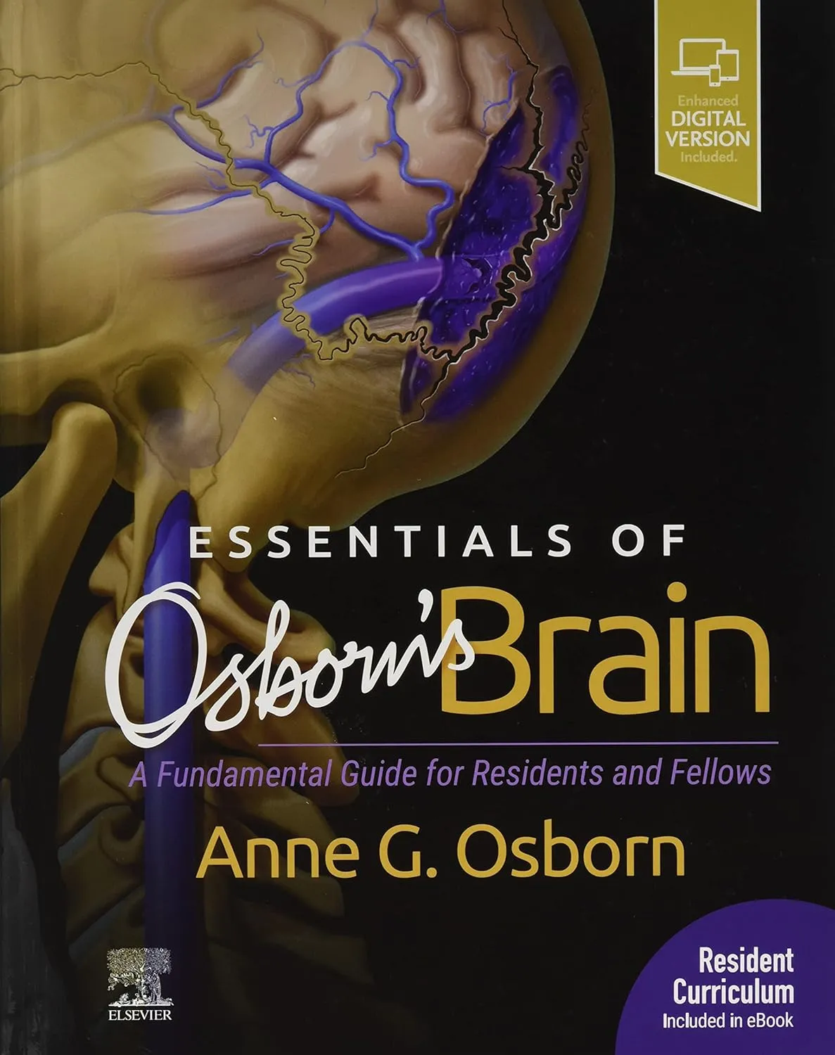 Essentials of Osborn's Brain-1E
