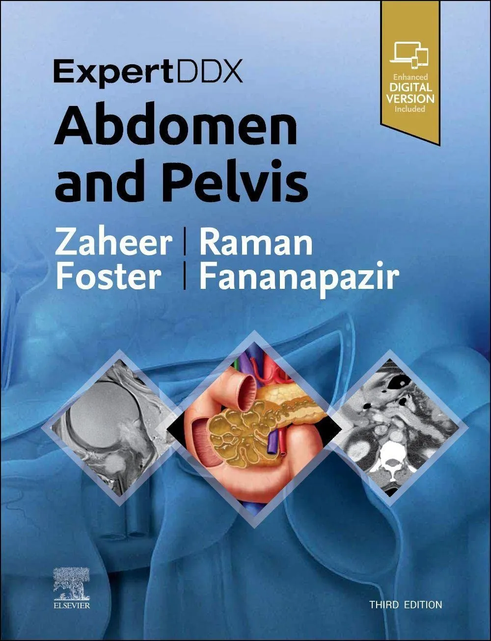 ExpertDDx: Abdomen and Pelvis-3E