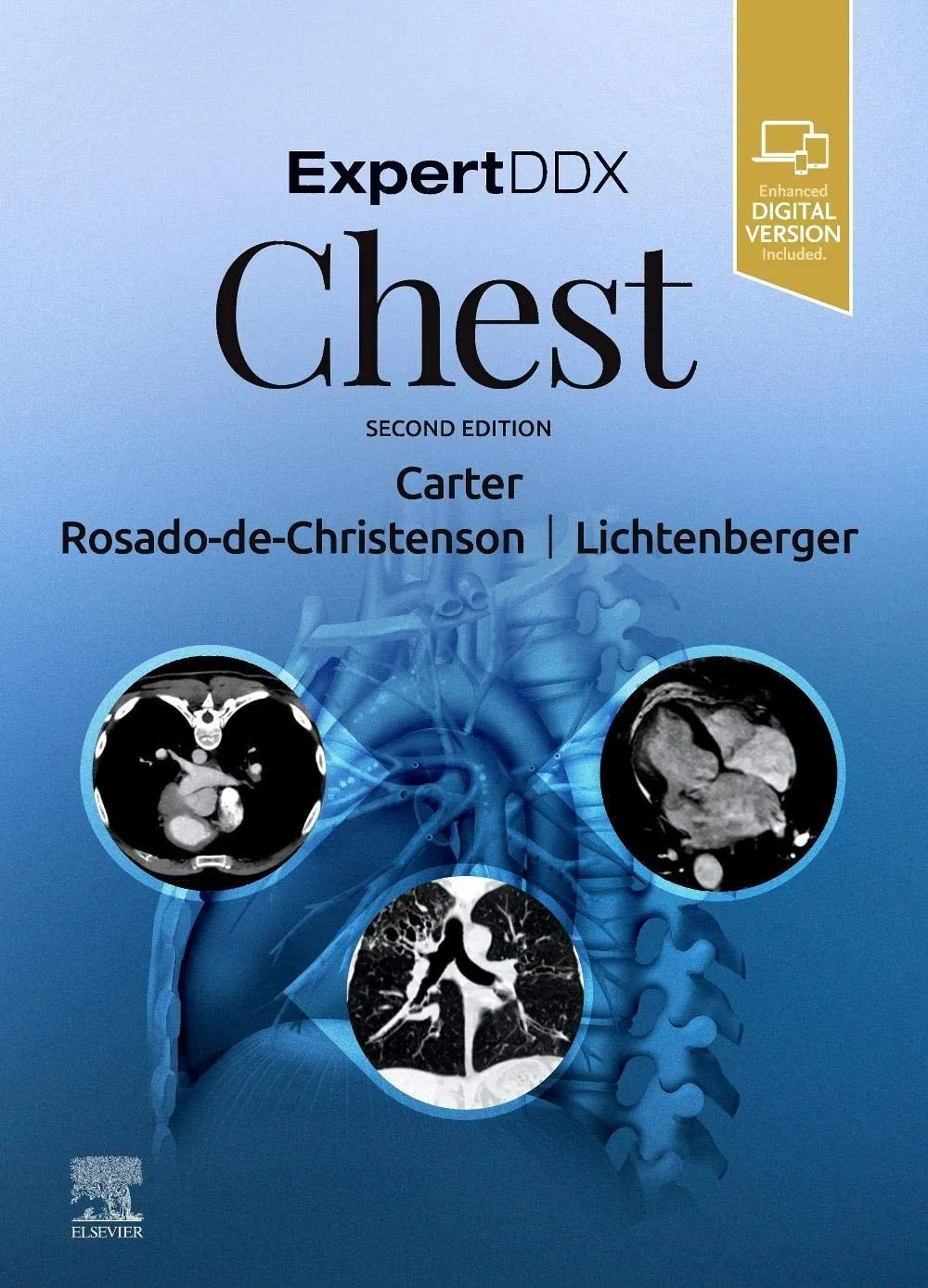ExpertDDx: Chest-2E