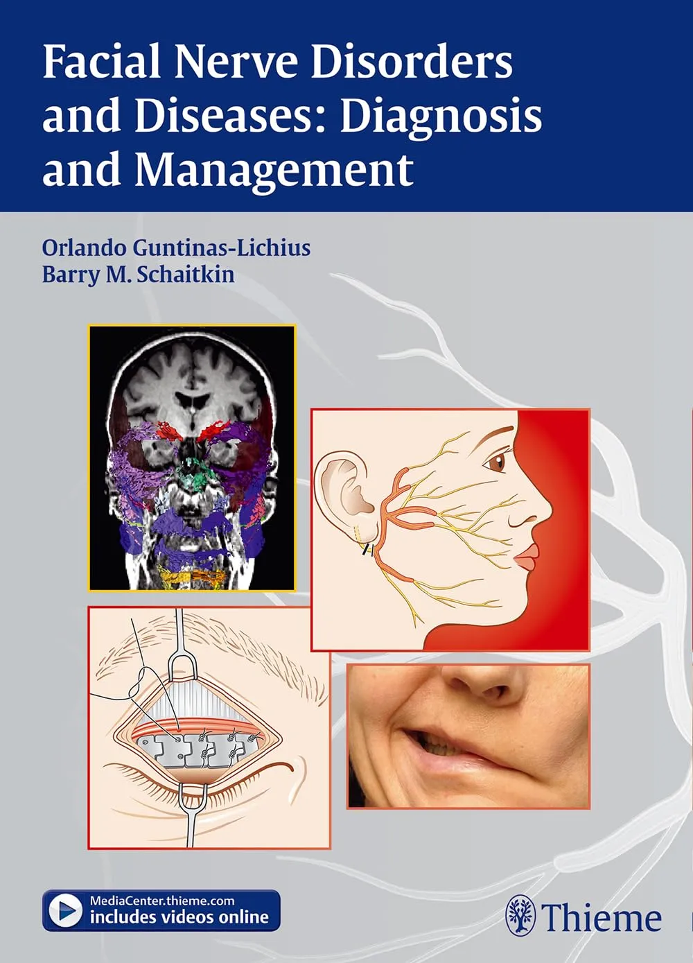 Facial Nerve Disorders and Diseases: Diagnosis and Management 1st Edition