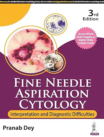 Fine Needle Aspiration Cytology | Interpretation and Diagnostic Difficulties - 3rd Edition