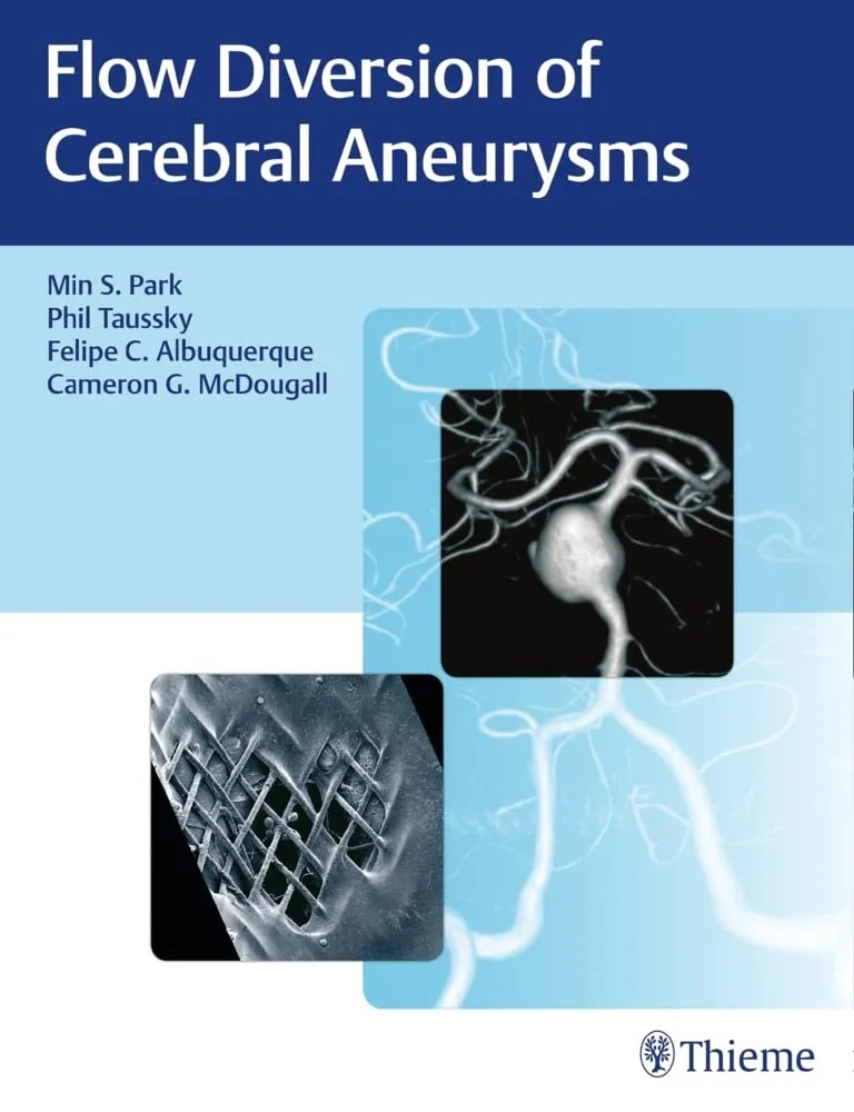 Flow Diversion of Cerebral Aneurysms 1st Edition