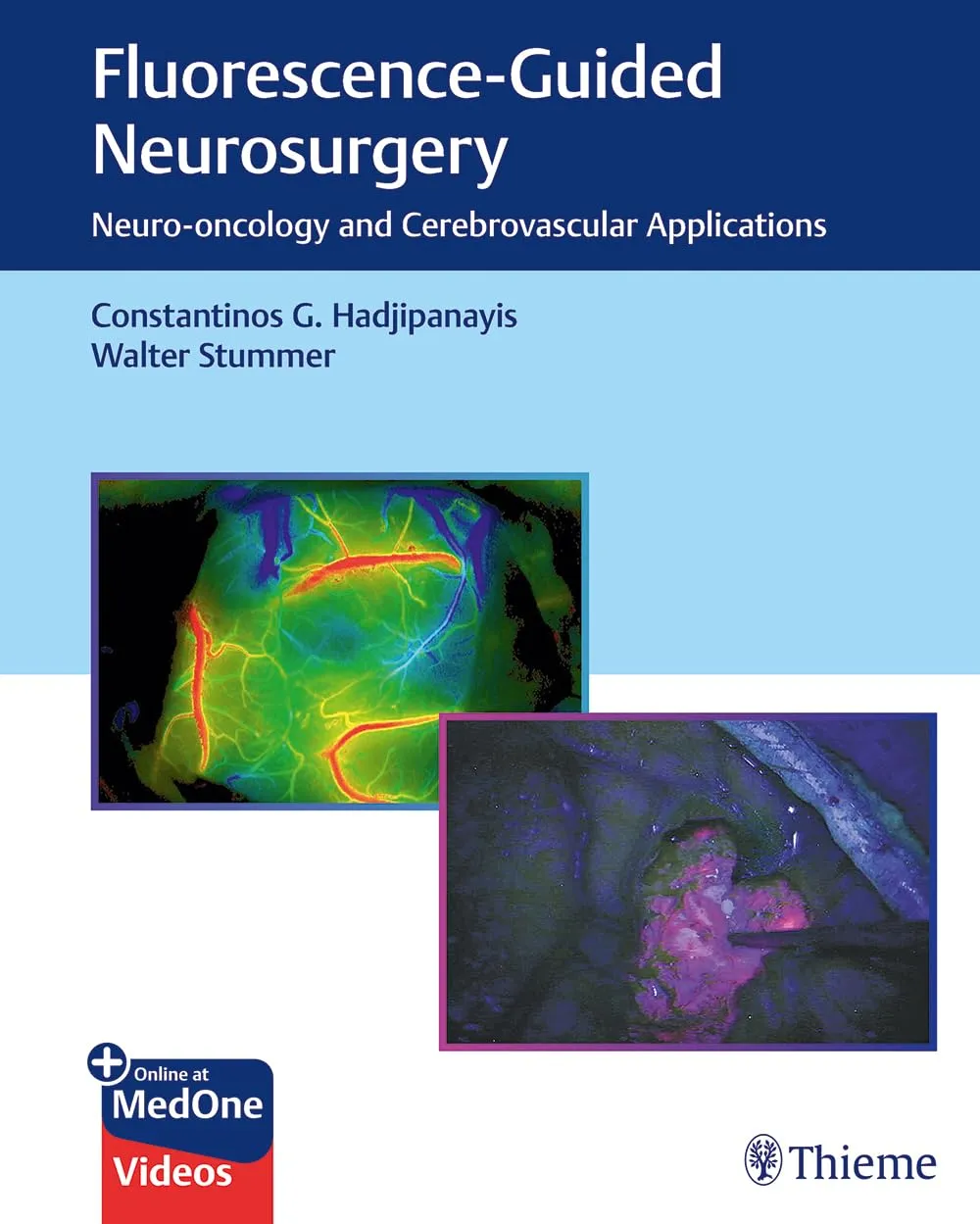 Flurescence - Guided Neurosurgery 1st Ed.