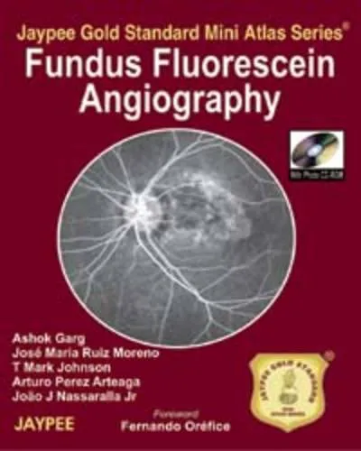 Fundus Fluorescein Angiography Jaypee Gold Standard Mini Atlas Series with Photo Cd-rom - 1st Edition