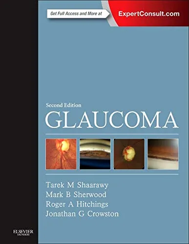 Glaucoma Expert Consult | 2-Volume Set - Second Edition