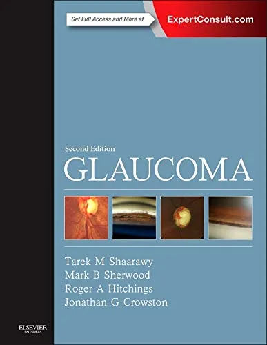 Glaucoma - Expert Consult -2-Vol Set - 2E