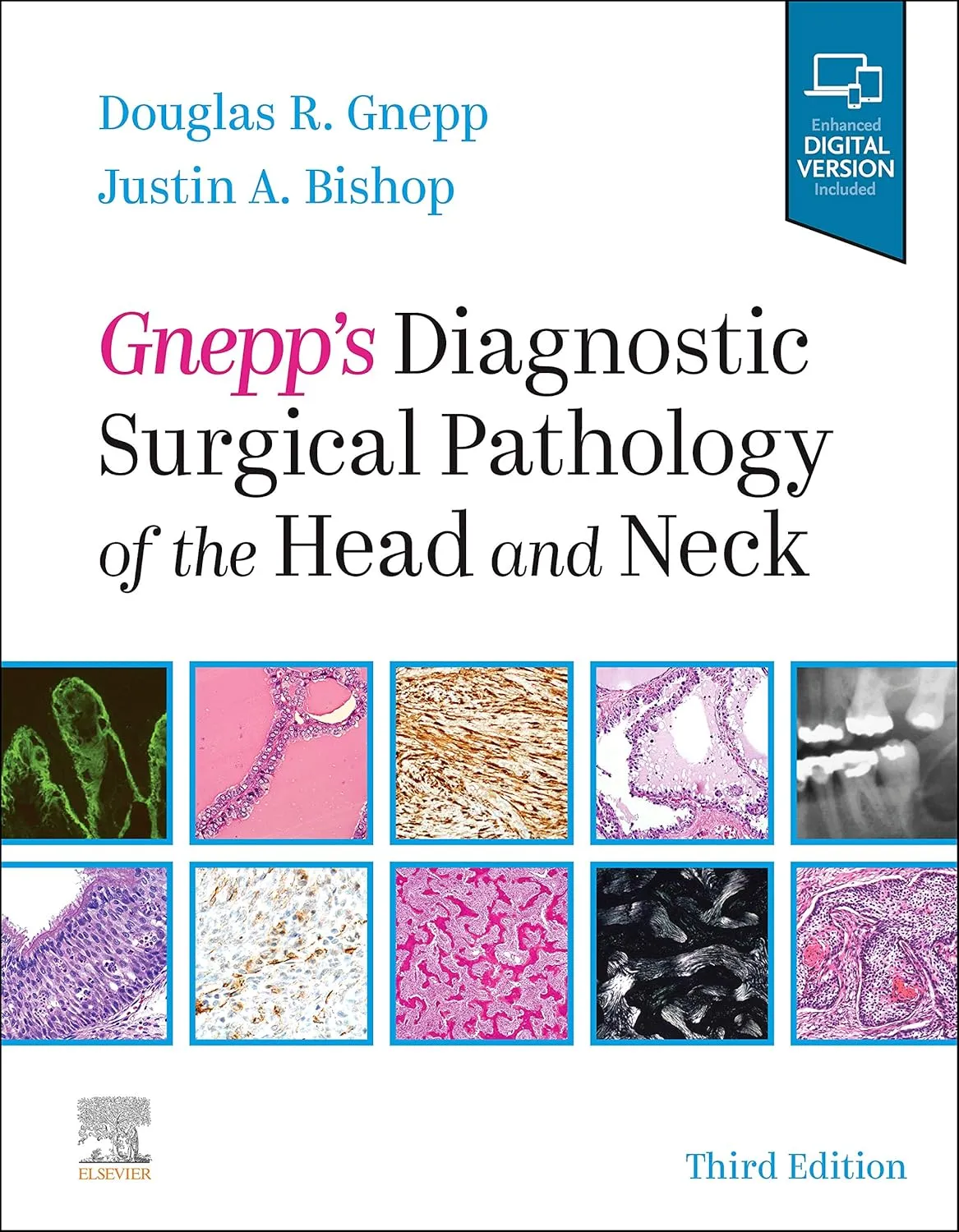 Gnepp's Diagnostic Surgical Pathology of the Head and Neck-3E