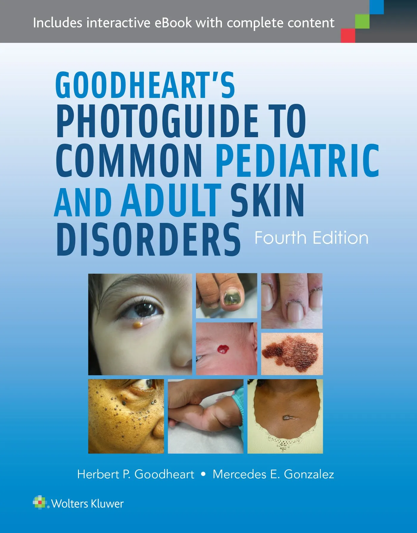 Goodheart's Photoguide To Common Skin Disorders