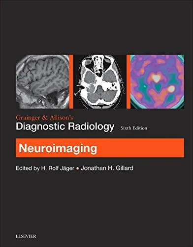 Grainger and Allison's Diagnostic Radiology: Neuroimaging - Essential Reference