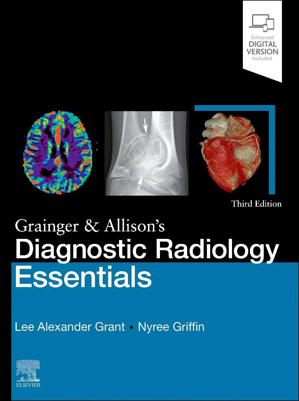 Grainger & Allison's Diagnostic Radiology Essentials - 3ED