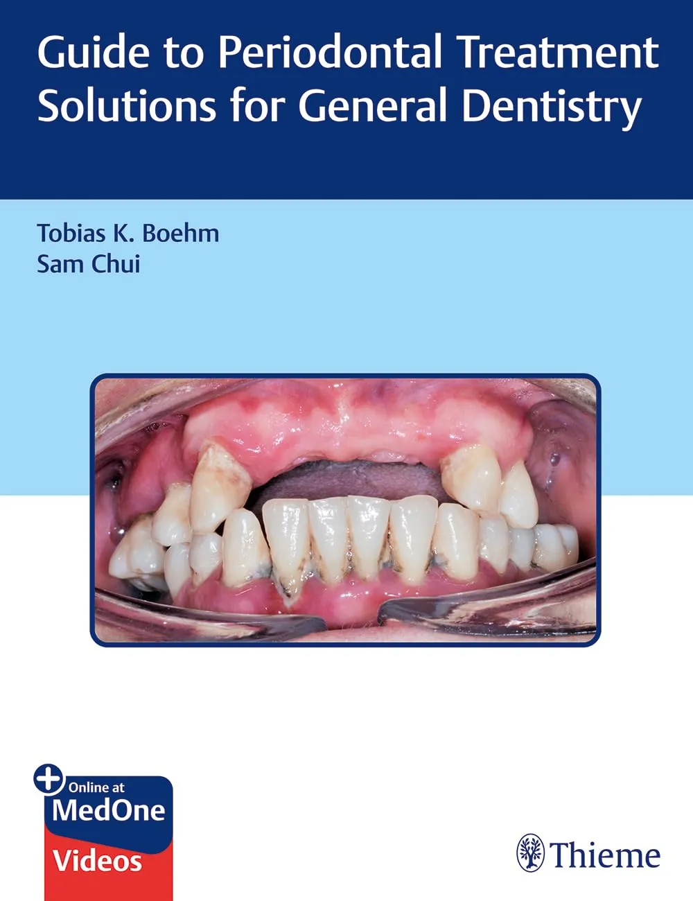 Guide to Periodontal Treatment Solutions for General Dentistry 1st Ed.