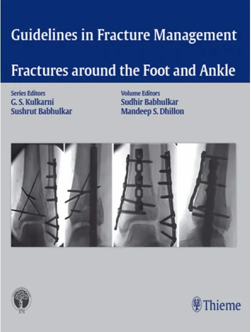 Guidelines Fracture Around the Foot and Ankle -1st Edition