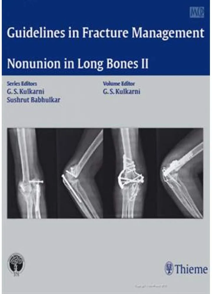Nonunion in Long Bones-Part II