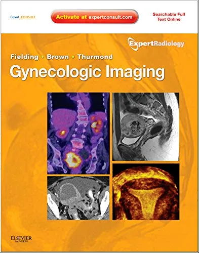 Gynecologic Imaging- Expert Radiology Series -1E