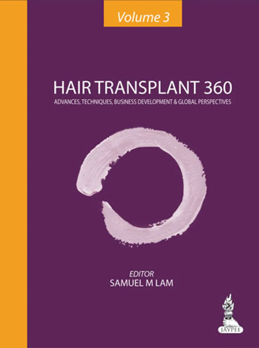 Hair Transplant 360 | Advances, Techniques, Business Development, and Global Perspectives (Volume-3)