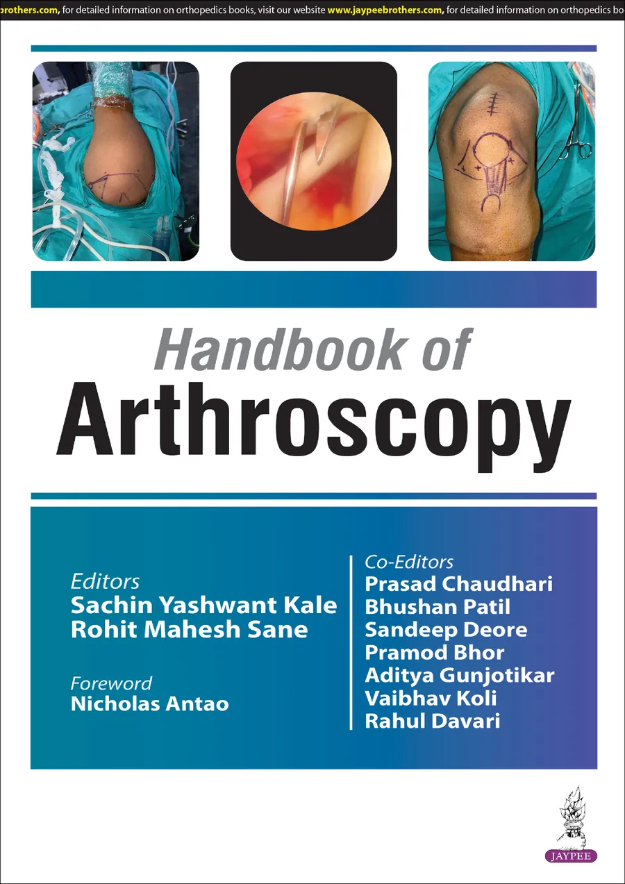 Handbook of Arthroscopy