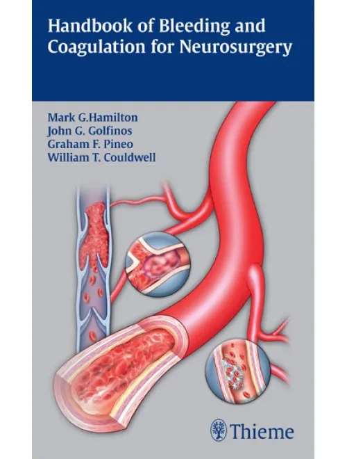 Handbook of Bleeding and Coagulation for Neurosurgery - 1st Edition