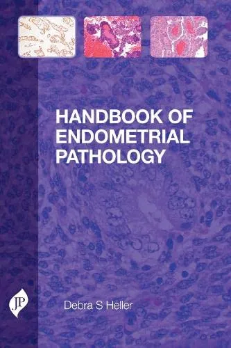 Handbook of Endometrial Pathology - 1st Edition