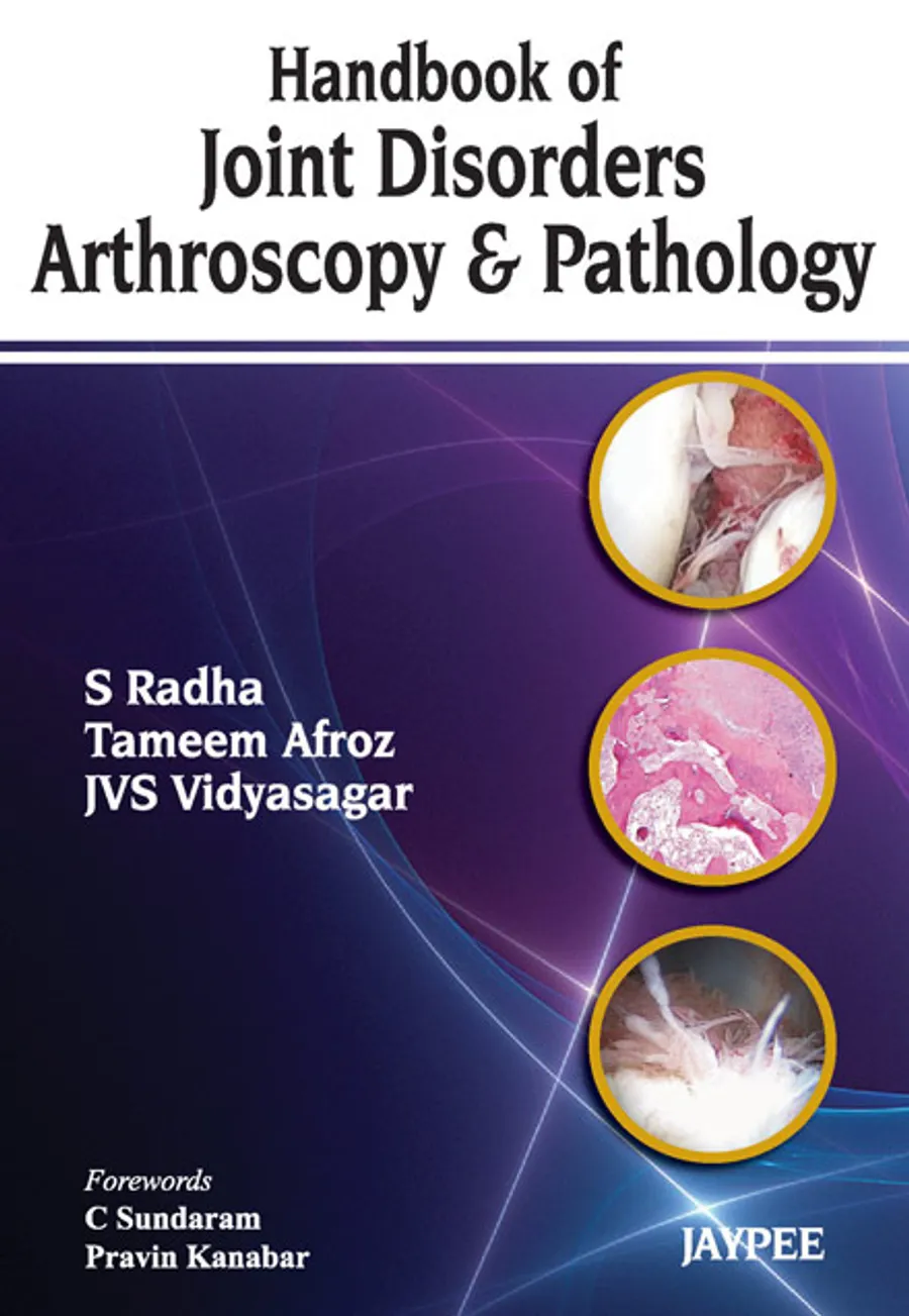 Handbook of Joint Disorders | Arthroscopy and Pathology