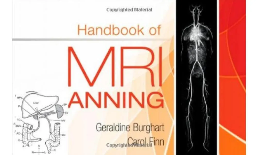 Handbook of MRI Scanning - 1E