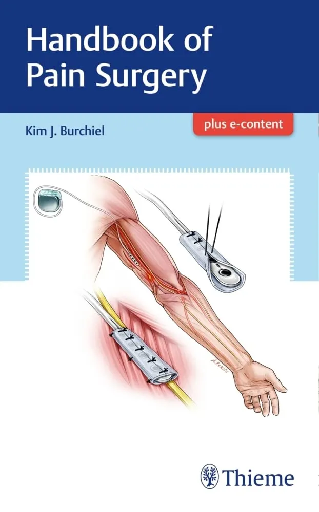 Handbook of Pain Surgery 1st Edition