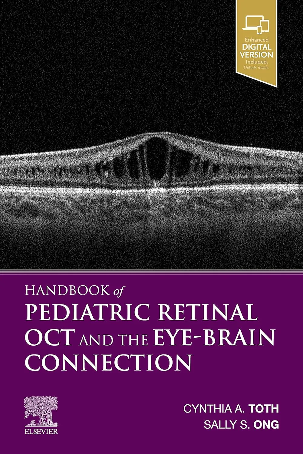 Handbook of Pediatric Retinal OCT and the Eye-Brain Connection-1E