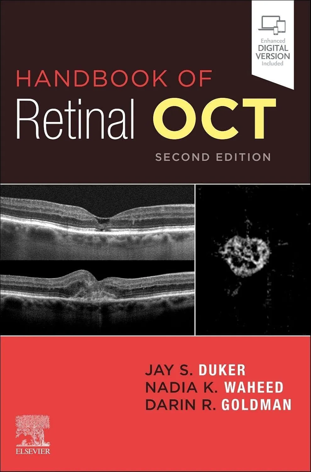 Handbook of Retinal OCT: Optical Coherence Tomography-2E