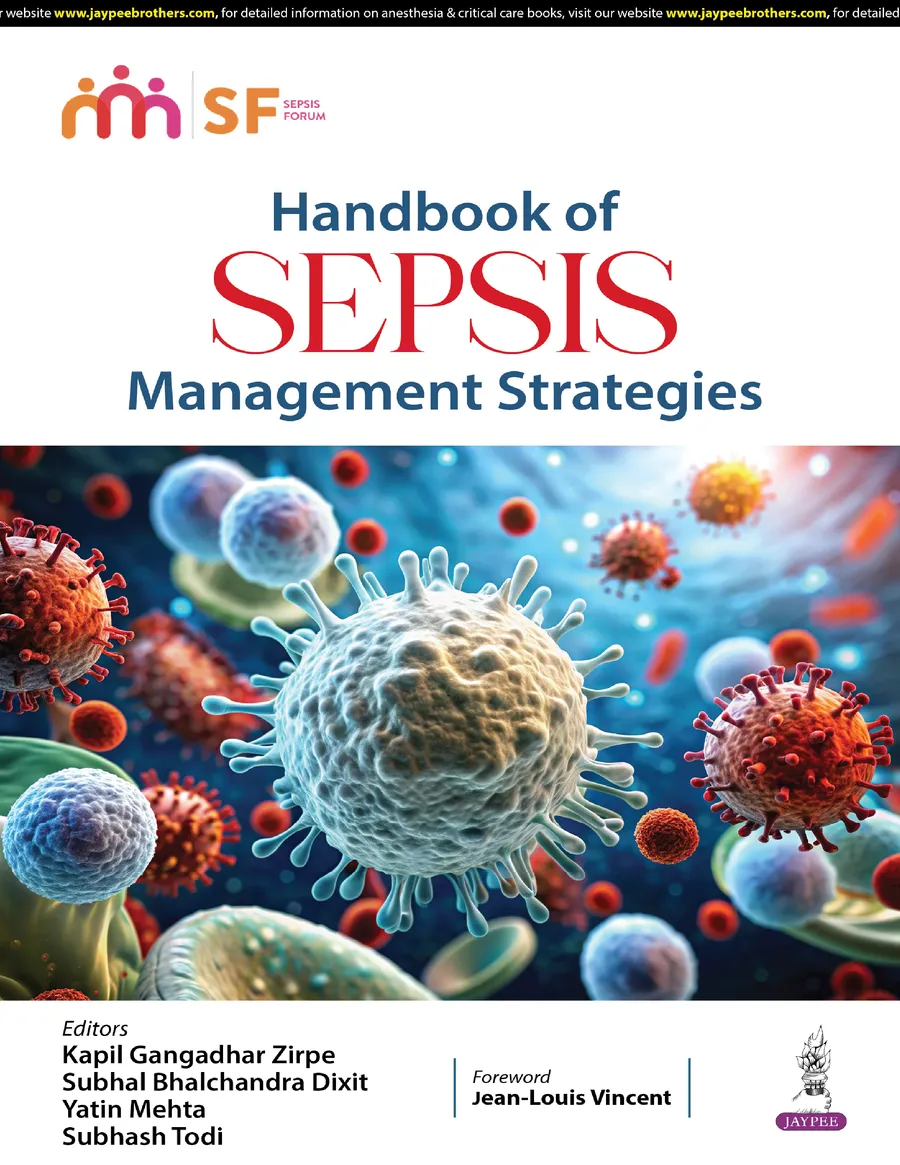 Handbook of SEPSIS | Management Strategies