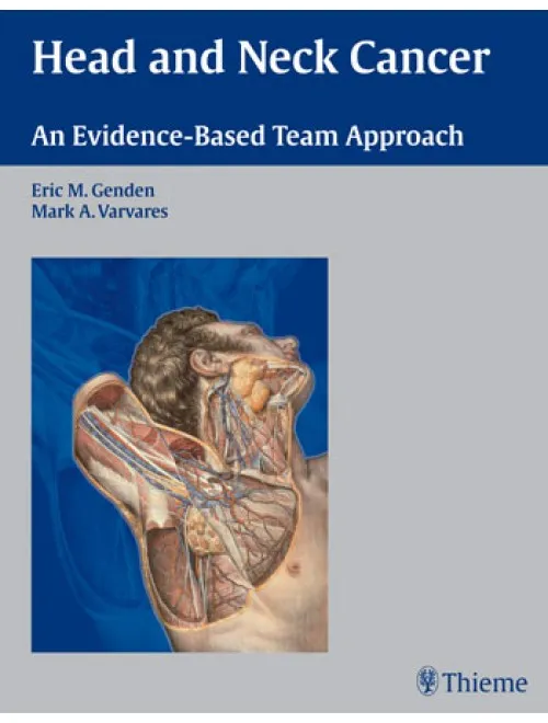 Head and Neck Cancer - 1st Edition