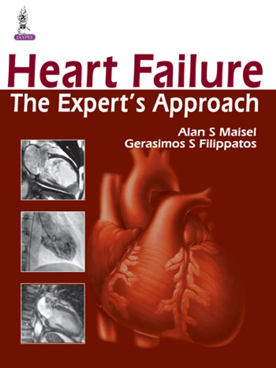 Image of Heart Failure | The Experts Approach