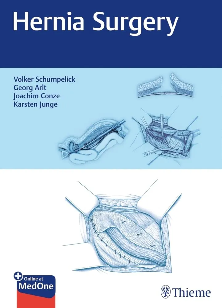 Hernia Surgery 1st Ed.
